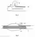 Fig. 04 - Methods and devices for reducing or blocking blood flow to a selected blood vessel or part thereof