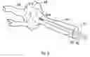 Fig. 06 - Methods and devices for reducing or blocking blood flow to a selected blood vessel or part thereof