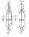 Fig. 09 - Embolic protection system