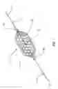 Fig. 02 - SLIDEABLE VASCULAR FILTER