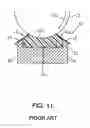Fig. 12 - Sealing assembly for an ink chamber which includes self-lubricating anilox roll seal with improved blade/seal area