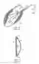 Fig. 06 - Method for surgical dissection, sizing and expansion