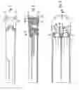 Fig. 06 - Medical pump