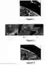 Fig. 02 - Method for treating and/or preventing intestinal bacterial imbalance
