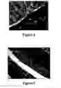 Fig. 03 - Method for treating and/or preventing intestinal bacterial imbalance