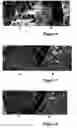 Fig. 04 - Method for treating and/or preventing intestinal bacterial imbalance