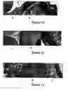 Fig. 06 - Method for treating and/or preventing intestinal bacterial imbalance