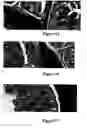 Fig. 07 - Method for treating and/or preventing intestinal bacterial imbalance