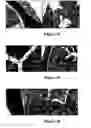Fig. 08 - Method for treating and/or preventing intestinal bacterial imbalance
