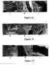Fig. 09 - Method for treating and/or preventing intestinal bacterial imbalance