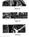 Fig. 10 - Method for treating and/or preventing intestinal bacterial imbalance