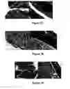 Fig. 11 - Method for treating and/or preventing intestinal bacterial imbalance