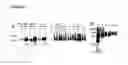 Fig. 03 - Glycosylated polypeptides produced in yeast mutants and methods of use thereof