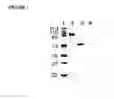 Fig. 04 - Glycosylated polypeptides produced in yeast mutants and methods of use thereof