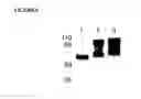 Fig. 06 - Glycosylated polypeptides produced in yeast mutants and methods of use thereof
