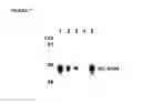 Fig. 08 - Glycosylated polypeptides produced in yeast mutants and methods of use thereof