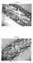 Fig. 02 - Biocompatible Coating, Method, and Use of Medical Surfaces
