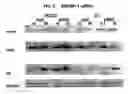 Fig. 04 - Silencing RNA molecules and their use in bone formation