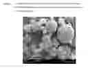 Fig. 03 - Inhalation Powder Containing the CGRP antagonist BIBN4096 and Process for the Preparation Thereof