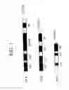 Fig. 02 - PUFA POLYKETIDE SYNTHASE SYSTEMS AND USES THEREOF