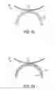 Fig. 04 - Patterning non-planar surfaces
