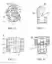 Fig. 06 - Orthodontic bracket
