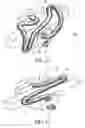 Fig. 09 - Orthodontic bracket