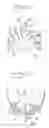 Fig. 04 - System and Arrangement for Production and Insertion of a Dental Bridge Structure