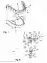 Fig. 02 - Denture attachment system