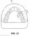 Fig. 09 - DENTURE SYSTEM KIT AND METHOD