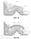Fig. 10 - DENTURE SYSTEM KIT AND METHOD