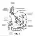 Fig. 02 - Training aid for a dental injection