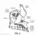 Fig. 03 - Training aid for a dental injection