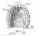 Fig. 05 - Training aid for a dental injection