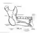 Fig. 07 - Training aid for a dental injection