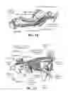 Fig. 10 - Training aid for a dental injection
