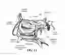 Fig. 12 - Training aid for a dental injection