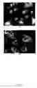 Fig. 04 - COMPOSITION, METHOD AND KIT FOR REDUCING BACKGROUND STAINING