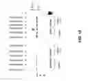 Fig. 16 - ISOLATED LECTIN POLYPEPTIDES CONSISTING OF TRUNCATED MAMMALIAN UDP-GalNAc:POLYPEPTIDE N- ACETYLGALACTOSAMINYLTRANSFERASES