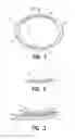 Fig. 02 - Neonatal chest brace and method of using same to prevent collapse of a chest wall