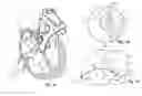 Fig. 02 - Devices for reducing the size of an internal tissue opening
