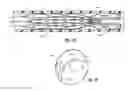 Fig. 05 - Devices for reducing the size of an internal tissue opening