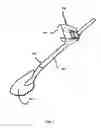 Fig. 02 - Handle attachment assembly