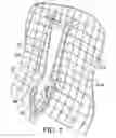 Fig. 02 - Two-piece tie down clip for sheet material