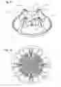 Fig. 07 - Tree stand with fast-acting screw assembly and method of using same