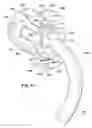 Fig. 07 - Ventilator to tracheotomy tube coupling