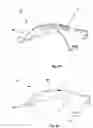 Fig. 09 - Tongue stabilization device and methods of using the same