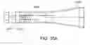 Fig. 43 - Tongue stabilization device and methods of using the same