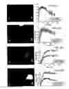Fig. 31 - Imaging of enzyme activity