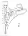 Fig. 07 - Rotational, translational and torqueing control members for an endoscopic instrument